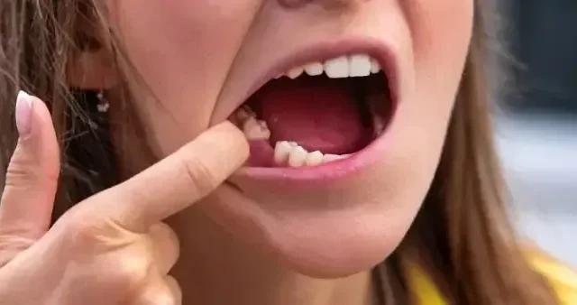 Wie lässt sich schnell ein Zahn wachsen? Sehr vielversprechende neue Behandlung